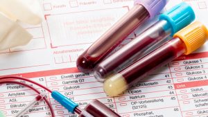 Цены на сдачу анализа крови на биохимию платно в Новосибирске