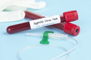 Анализ крови на сифилис в Новосибирске