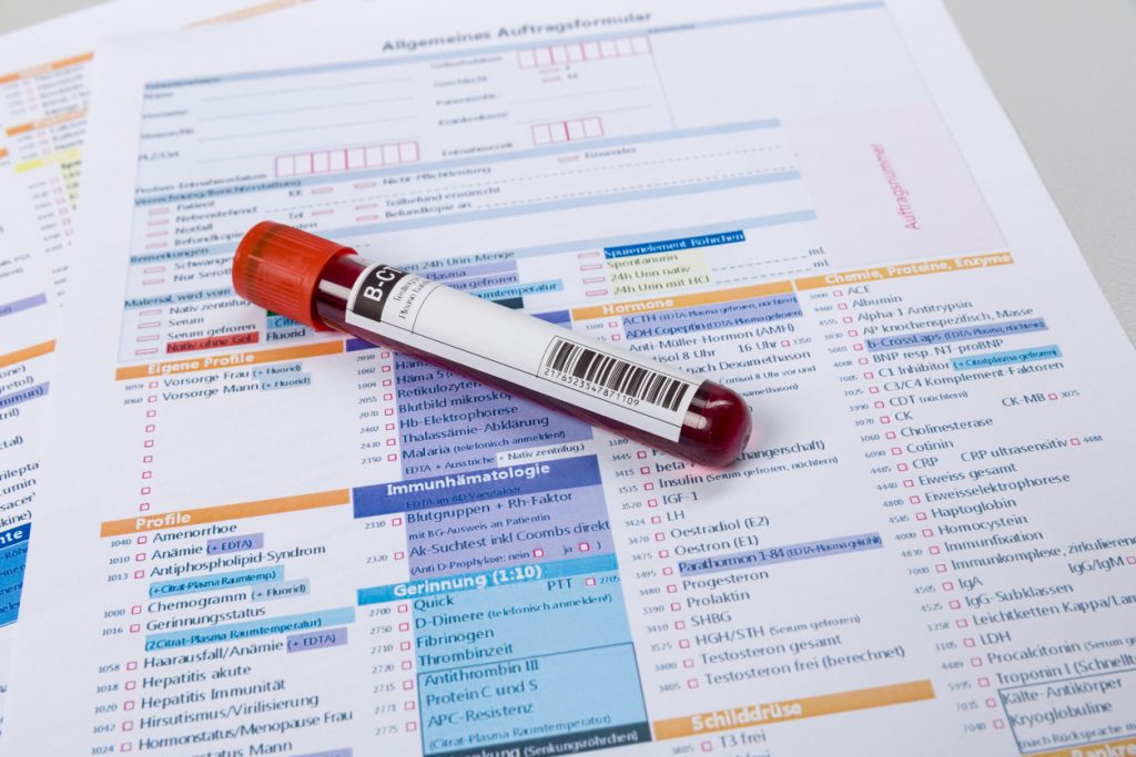 Сдача анализа крови на гепатит в Новосибирске в клинике Шикон